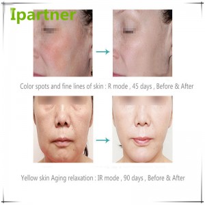 Varm försäljning LED Photon Therapy Beauty Equipment för hudvård