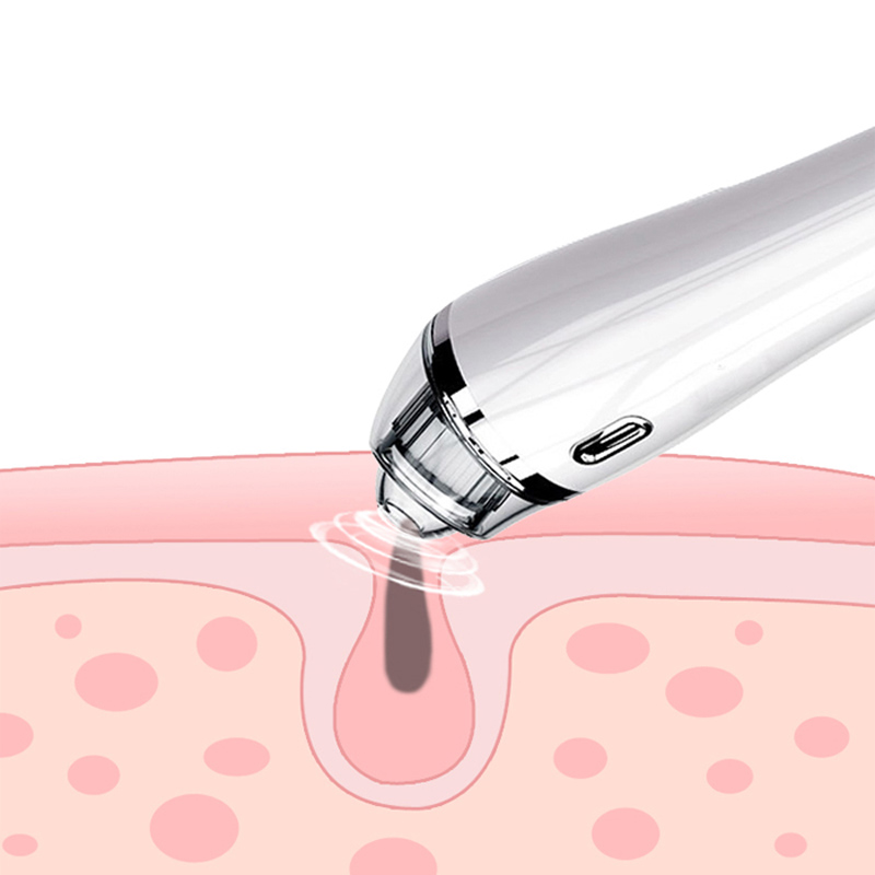 Blackhead Remover Vacuum - Pore Cleaner Electric Blackhead Suction Facial Comedo Acne Extractor Tool för kvinnor och män
