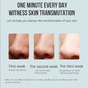 Electric Extractor Acne Removal Blackhead Remover Vacuum Beauty Machine Pore Cleaner