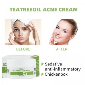 Tea Tree Oil Acne Cream