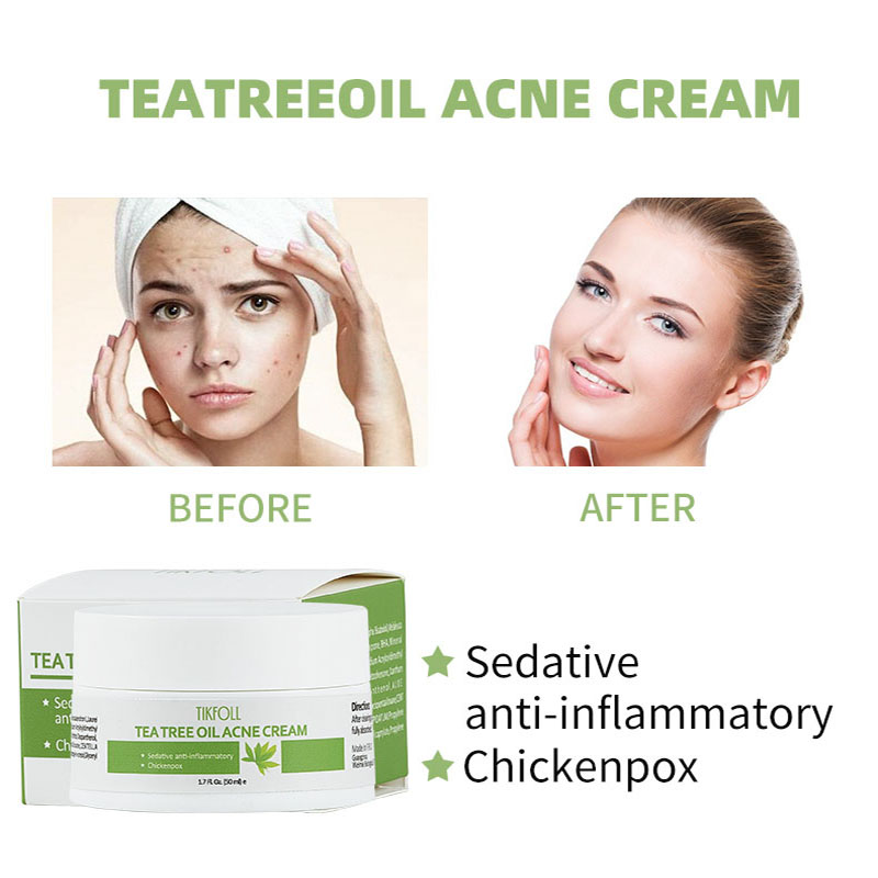 Tea Tree Oil Acne Cream